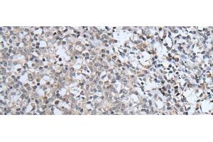 Immunohistochemistry of paraffin-embedded Human tonsil tissue using ABCA6 Polyclonal Antibody at dilution of 1:40(x200) (ABCA6 抗体)