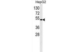 Western Blotting (WB) image for anti-Aldehyde Dehydrogenase 2 Family (Mitochondrial) (ALDH2) antibody (ABIN2995313) (ALDH2 抗体)