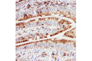 Anti-Hsp105 antibody, IHC(F) IHC(F): Rat Intestine Tissue (HSPH1 抗体  (C-Term))