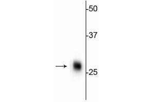 Western blot of rat cerebellar lysate showing specific immunolabeling of the ~ 28 kDa calbindin protein. (CALB1 抗体)