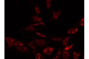 ABIN6267435 staining 293 by IF/ICC. (Synaptotagmin 抗体  (pThr202))