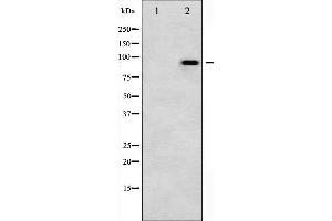 Western blot analysis of Catenin- beta phosphorylation expression in UV treated COS7 whole cell lysates,The lane on the left is treated with the antigen-specific peptide.