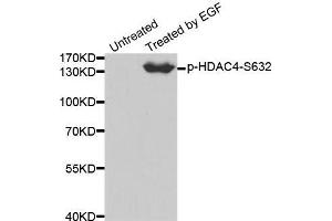 Western blot analysis of extracts from 293 cells using Phospho-HDAC4-S632 antibody.