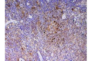 IHC analysis of ICOS using anti-ICOS antibody . (ICOS 抗体  (AA 21-200))