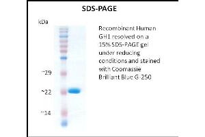 SDS-PAGE (SDS) image for Growth Hormone 1 (GH1) (Active) protein (ABIN5509312) (Growth Hormone 1 Protein (GH1))