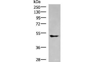 Western blot analysis of A549 cell lysate using KCNJ2 Polyclonal Antibody at dilution of 1:550 (KCNJ2 抗体)