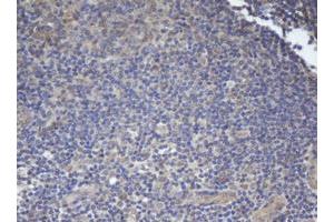 Image no. 2 for anti-B-Cell CLL/lymphoma 10 (BCL10) antibody (ABIN1496847) (BCL10 抗体)