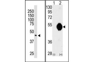 Image no. 1 for anti-DOK2 (DOK2) (C-Term) antibody (ABIN359960) (DOK2 抗体  (C-Term))