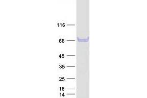 Western Blotting (WB) image for Aspartate beta-Hydroxylase (ASPH) (Transcript Variant 2) protein (Myc-DYKDDDDK Tag) (ABIN2715001)