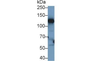 Western Blot; Sample: Human Liver lysate; Primary Ab: 1µg/ml Rabbit Anti-Human CP Antibody Second Ab: 0. (Ceruloplasmin 抗体  (AA 789-1065))