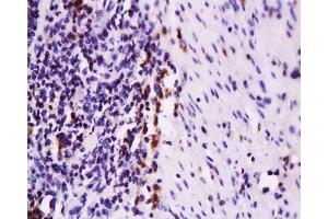 Formalin-fixed and paraffin embedded rat colon tissue labeled with Anti-Fas Polyclonal Antibody, Unconjugated  at 1:200 followed by conjugation to the secondary antibody and DAB staining (FAS 抗体  (AA 35-110))