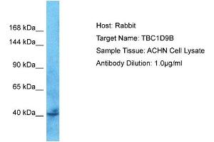 Host: Rabbit Target Name: TBC1D9B Sample Tissue: Human ACHN Whole Cell  Antibody Dilution: 1ug/ml (TBC1D9B 抗体  (C-Term))