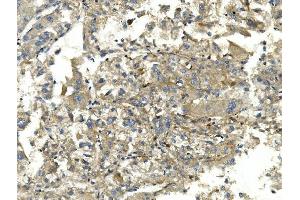 IHC analysis of EEF2 using anti-EEF2 antibody (ABIN7603141).