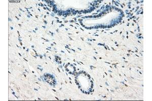 Immunohistochemical staining of paraffin-embedded Ovary tissue using anti-LTA4H mouse monoclonal antibody. (LTA4H 抗体)