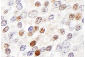 Immunohistochemistry (IHC) image for anti-Zinc Fingers and Homeoboxes 3 (ZHX3) (AA 150-200) antibody (ABIN7453491)