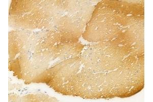 ABIN6265804 and ABIN6266666 at 1/100 staining human normal gastric tissue by IHC-P. (gamma Tubulin 抗体  (N-Term))