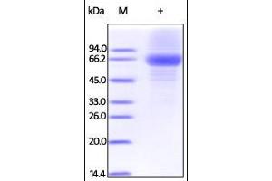 SDS-PAGE (SDS) image for Interleukin 12 alpha (IL12A) (AA 23-219) protein (Fc Tag) (ABIN2181329)