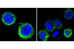 Confocal immunofluorescence analysis of methanol-fixed HEK293 cells trasfected with AXL-hIgGFc using AXL mouse mAb(green), showing cytoplasmic and membrane localization. (AXL 抗体)