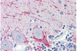 Human Brain, Cerebellum (formalin-fixed, paraffin-embedded) stained with VAMP2 antibody ABIN364330 at 10 ug/ml followed by biotinylated anti-mouse IgG secondary antibody ABIN481714, alkaline phosphatase-streptavidin and chromogen. (VAMP2 抗体  (AA 1-89))