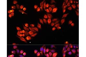 Immunofluorescence analysis of HeLa cells using Heparanase 1 Polyclonal Antibody at dilution of 1:100. (HPSE 抗体)
