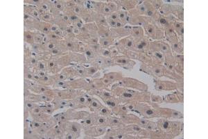Used in DAB staining on fromalin fixed paraffin- embedded Kidney tissue (CELSR3 抗体  (AA 1181-1421))