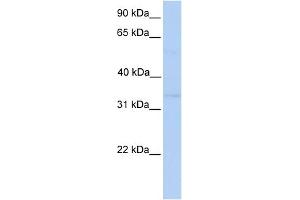 WB Suggested Anti-NDE1 Antibody Titration: 0. (NDE1 抗体  (Middle Region))