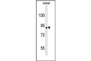Western blot analysis of KIAA1680 Antibody (C-term) in Jurkat cell line lysates (35ug/lane). (MGC48628 (AA 787-816), (C-Term) 抗体)
