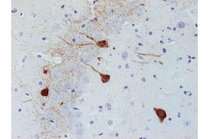 Immunostaining of paraffin embedded section of mouse brain (dilution 1 : 500). (PVALB 抗体)