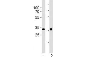 Western blot analysis of lysate from 1) HepG2 and 2) Y79 cell line using OTX2 antibody at 1:1000. (OTX2 抗体  (C-Term))