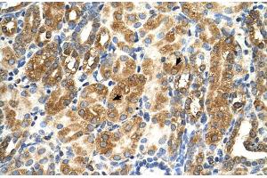 Immunohistochemistry (IHC) image for anti-MAS1 Oncogene (MAS1) (Middle Region) antibody (ABIN2784455)