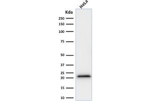 Western Blot Analysis of human HeLa cell lysate using p21 Mouse Recombinant Monoclonal Antibody (rCIP1/823). (Recombinant p21 抗体)