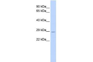 WB Suggested Anti-TRIM55 Antibody Titration:  0. (TRIM55 抗体  (Middle Region))