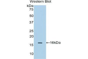 Detection of Recombinant CDK1, Human using Polyclonal Antibody to Cyclin Dependent Kinase 1 (CDK1) (CDK1 抗体  (AA 59-182))