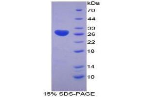 SDS-PAGE analysis of Human LOXL3 Protein. (LOXL3 蛋白)