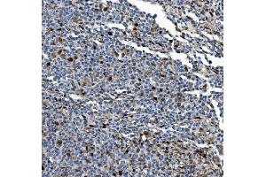 IHC analysis of PSMB5/MB1 using anti-PSMB5/MB1 antibody (ABIN7599183).