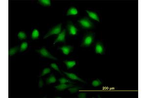 Immunofluorescence of monoclonal antibody to NME1 on HeLa cell. (NME1 抗体  (AA 1-152))