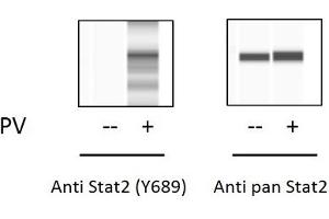 ELISA image for Signal Transducer and Activator of Transcription 2, 113kDa (STAT2) ELISA Kit (ABIN5691024)