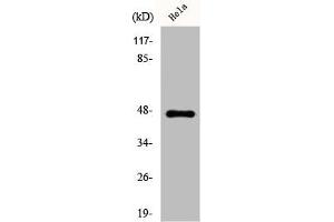 Western Blot analysis of HeLa cells using Cytokeratin 20 Polyclonal Antibody (Keratin 2 抗体  (C-Term))