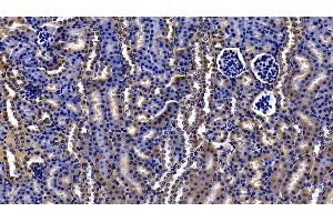 Detection of ORM2 in Mouse Kidney Tissue using Polyclonal Antibody to Orosomucoid 2 (ORM2) (Orosomucoid 2 抗体  (AA 19-207))