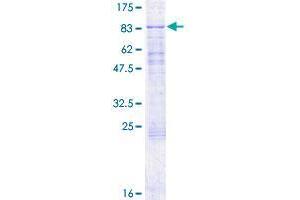 CDK5RAP1 Protein (AA 1-587) (GST tag)