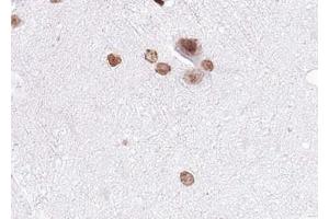 ABIN6267530 at 1/100 staining human brain tissue sections by IHC-P. (MAP2K4 抗体  (pSer80))
