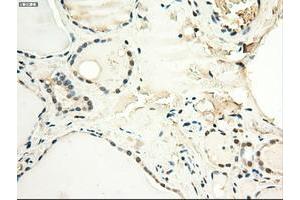 Image no. 14 for anti-Myc Proto-Oncogene protein (MYC) antibody (ABIN1497011) (c-MYC 抗体)