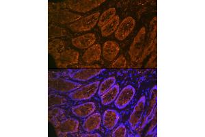 Immunofluorescence analysis of rat rectum cells using CE Rabbit mAb (ABIN7266085) at dilution of 1:100 (40x lens). (CEACAM6 抗体)