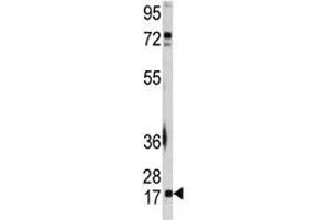 Western Blotting (WB) image for anti-Ubiquitin-Conjugating Enzyme E2I (UBE2I) (AA 1-30) antibody (ABIN3029438)