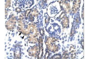 Image no. 1 for anti-Proteasome (Prosome, Macropain) 26S Subunit, ATPase, 3 (PSMC3) (AA 293-339) antibody (ABIN202439) (PSMC3 抗体  (AA 293-339))