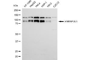 Western blotting analysis using HNRNPUL1 antibody (ABIN7798903).