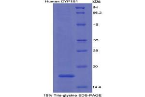 SDS-PAGE analysis of Human Cytochrome P450 1B1 Protein. (CYP1B1 蛋白)