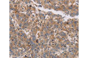 Immunohistochemistry (IHC) image for anti-Potassium Voltage-Gated Channel, Subfamily G, Member 1 (KCNG1) antibody (ABIN2433237) (KCNG1 抗体)