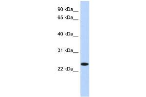 WB Suggested Anti-NKAIN4 Antibody Titration: 0. (NKAIN4 抗体  (N-Term))