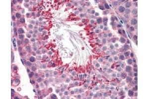 IHC Image for AP22588PU-N Mouse Testis (formalin-fixed, paraffin-embedded) stained with M6PRBP1followed by biotinylated anti-goat IgG secondary antibody LS-D3, alkaline phosphatase-streptavidin and chromogen. (PLIN3 抗体  (Internal Region))